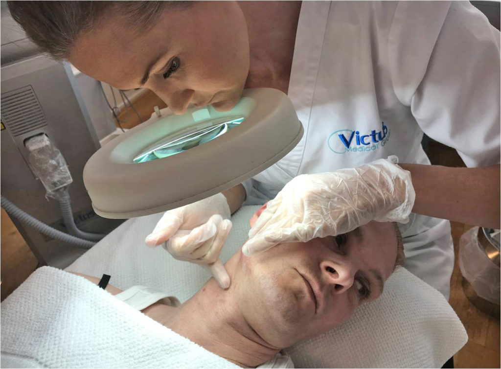 hårreducering, laserbehandling, diodus808, diodlaser, victus clinic, hudterapeut